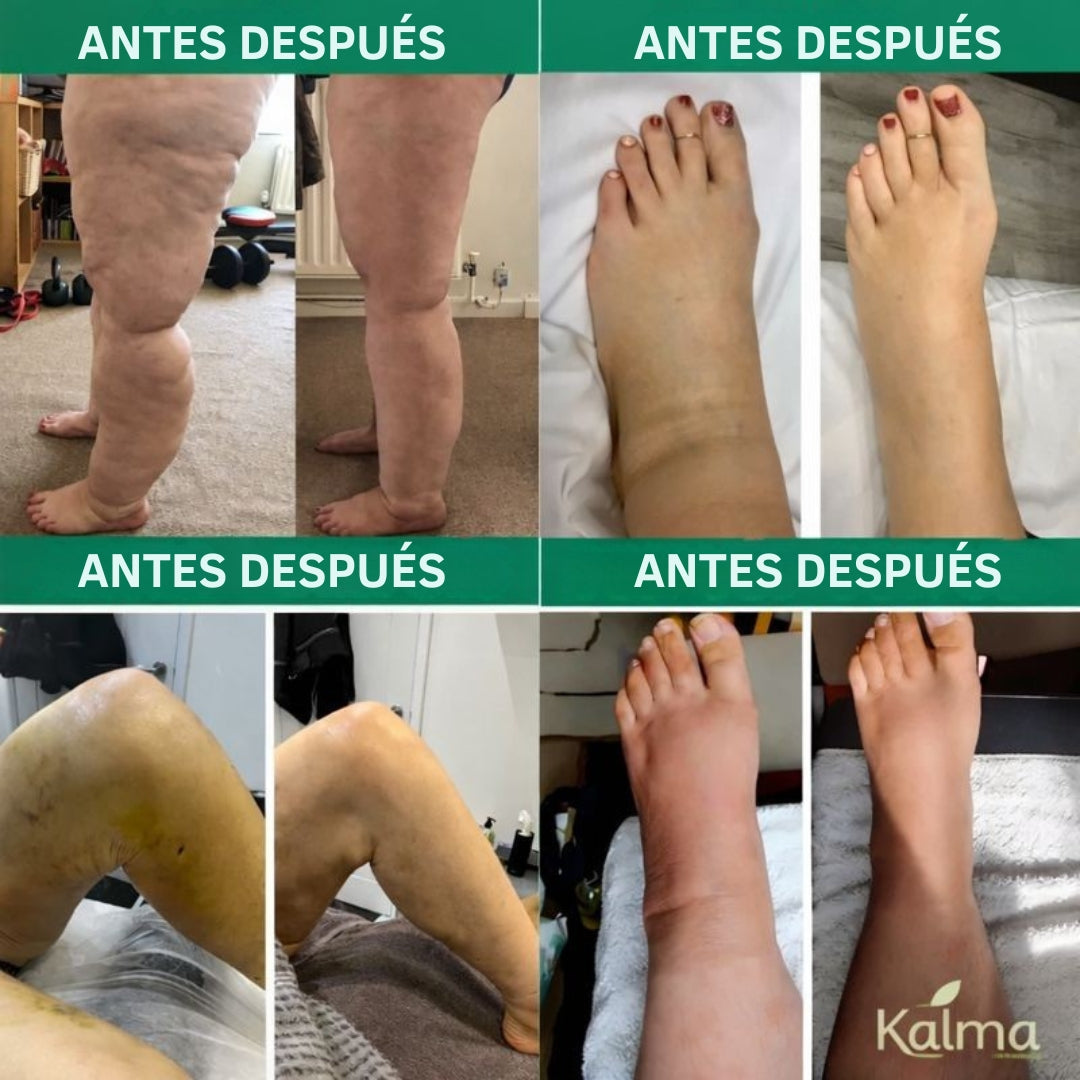 Kalma Revive – Masajeador de Compresión para Piernas Cansadas